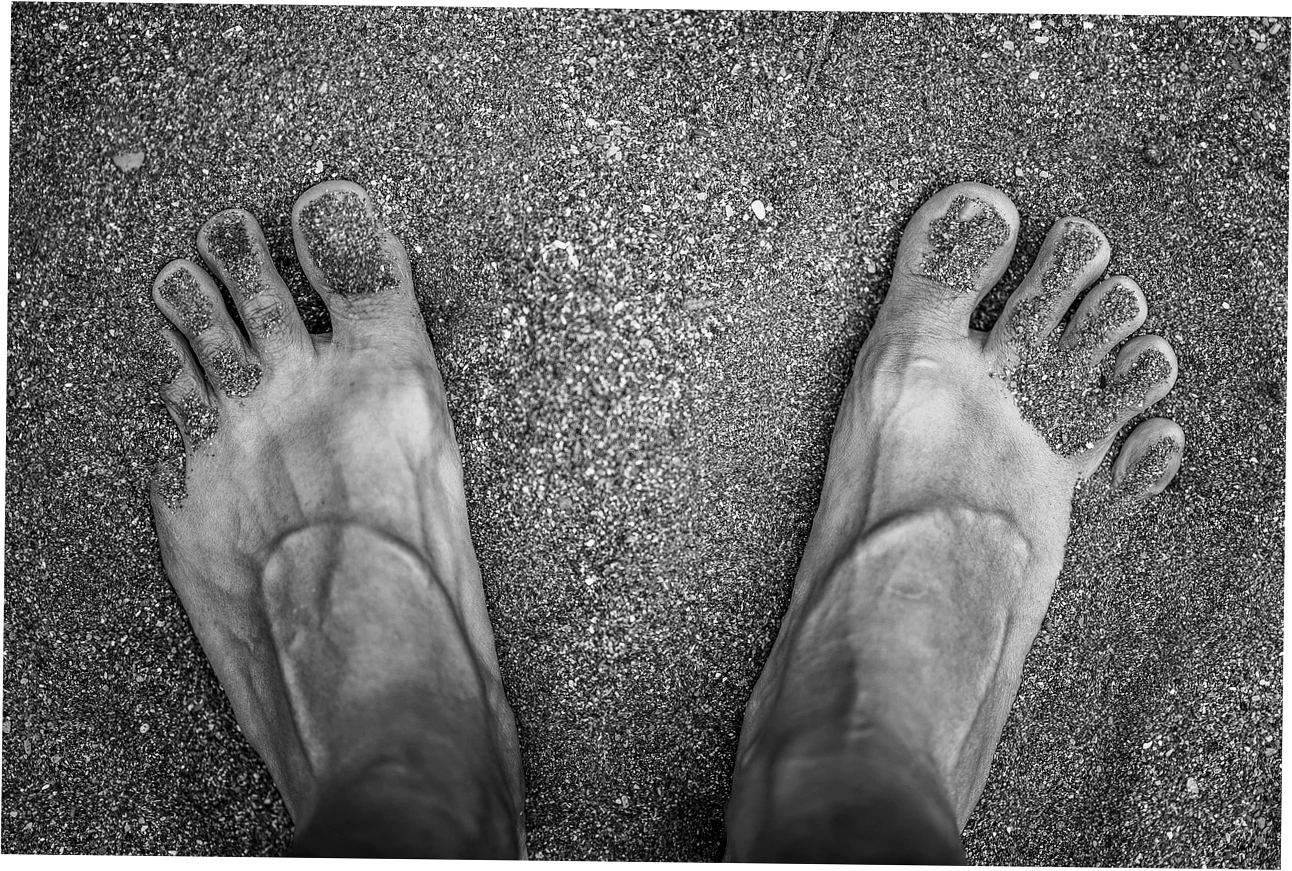 So why do your arches hurt and look flat?