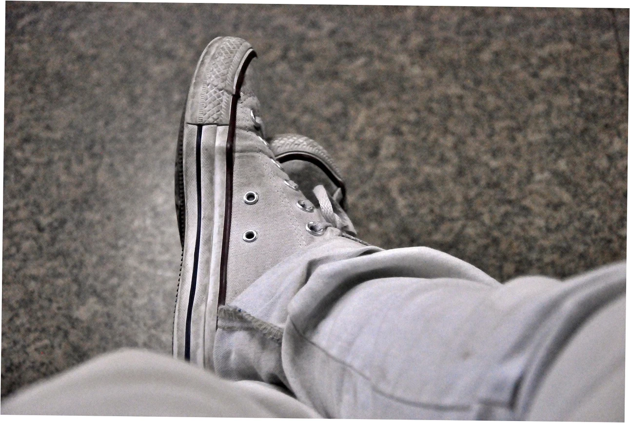 4. Identifying Symptoms of Rapidly Progressing Flatfoot