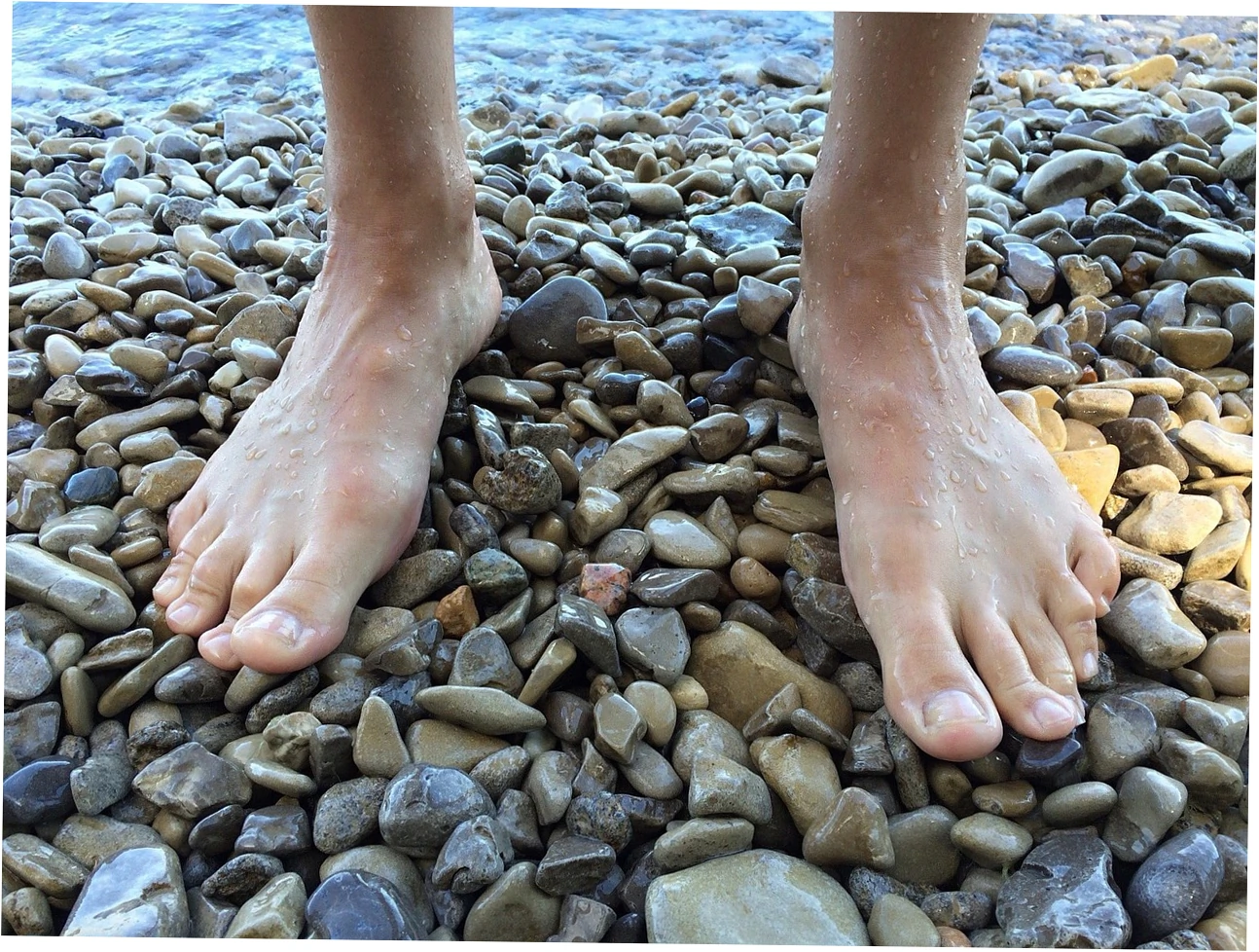 Defining Arch Pain and Flatfoot Appearance