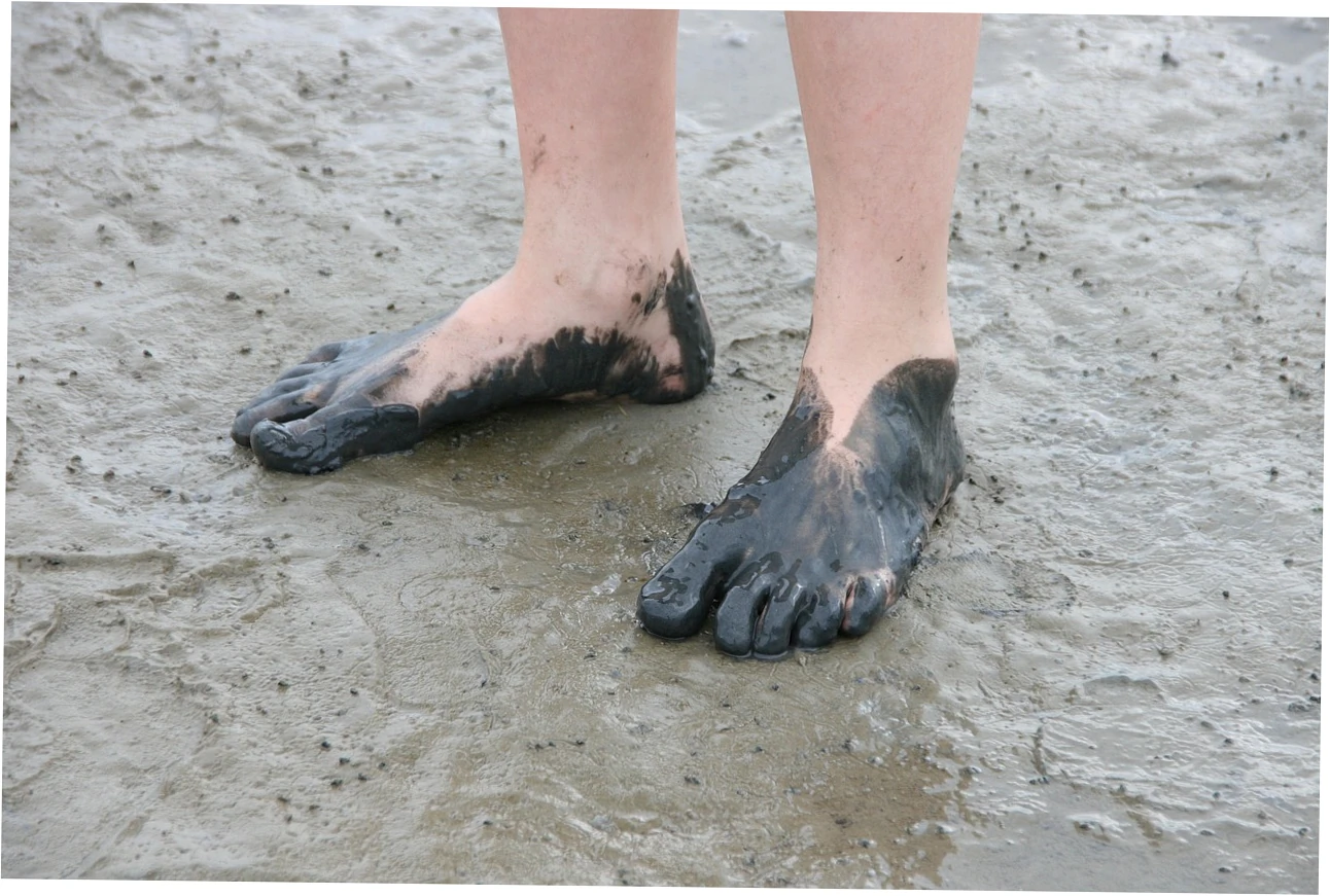 Systemic Diseases with Foot Manifestations